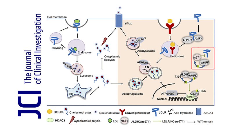 尹慧勇研究組發(fā)現(xiàn)乙醛脫氫酶2調(diào)控動(dòng)脈粥樣硬化的新機(jī)制