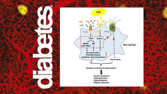 樂穎影研究組發(fā)現(xiàn)高脂飲食導(dǎo)致肥胖和糖脂代謝紊亂的新機制
