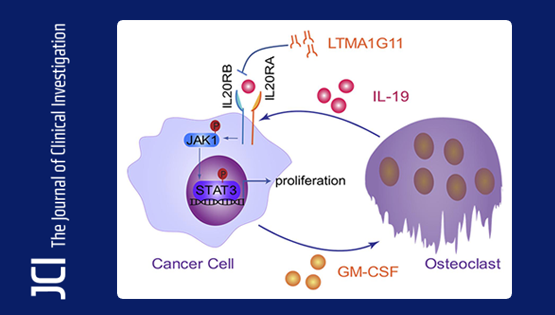 營養(yǎng)與健康所胡國宏研究組發(fā)現(xiàn)肺癌骨轉(zhuǎn)移調(diào)控新機(jī)制