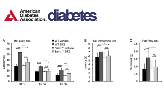 翟琦巍研究組發(fā)現(xiàn)防治糖尿病外周神經(jīng)病變的新靶點(diǎn)