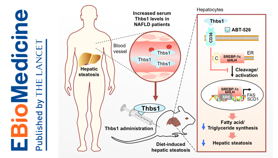 李于研究組合作發(fā)現(xiàn)非酒精性脂肪肝的新型生物標(biāo)志物與治療靶點