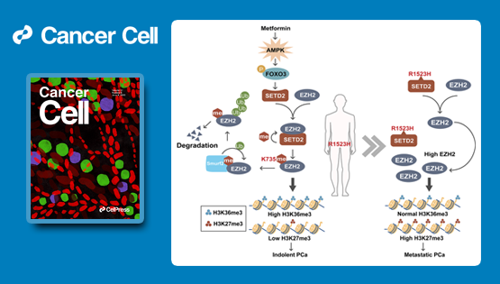秦駿研究組等合作研究揭示前列腺癌中組蛋白H3K36三甲基轉(zhuǎn)移酶SETD2的重要功能及調(diào)控機(jī)制