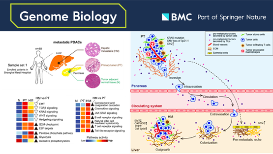 李虹、李亦學(xué)研究組合作破譯胰腺癌肝轉(zhuǎn)移的分子特征