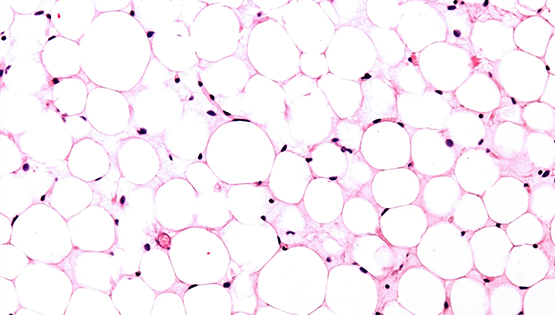 營(yíng)養(yǎng)與健康所翟琦巍研究組研究成果獲Nature研究亮點(diǎn)專評(píng)