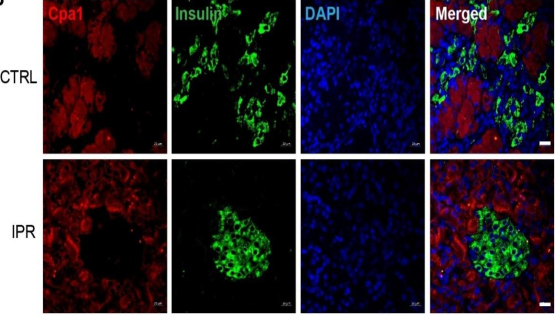 營養(yǎng)與健康所陳雁研究組發(fā)現(xiàn)間歇性蛋白限制能在大鼠模型上改善2型糖尿病