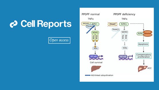 營養(yǎng)與健康所謝東研究組揭示PPDPF調(diào)控肝癌的新機(jī)制