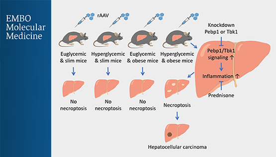 營養(yǎng)與健康所翟琦巍研究組揭示預(yù)防肥胖的糖尿病人肝癌發(fā)生的新思路以及AAV基因治療的新問題