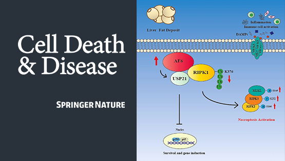 營養(yǎng)與健康所詹麗杏研究組在極性蛋白異常累積與肝代謝性疾病發(fā)病方面發(fā)表系列研究成果